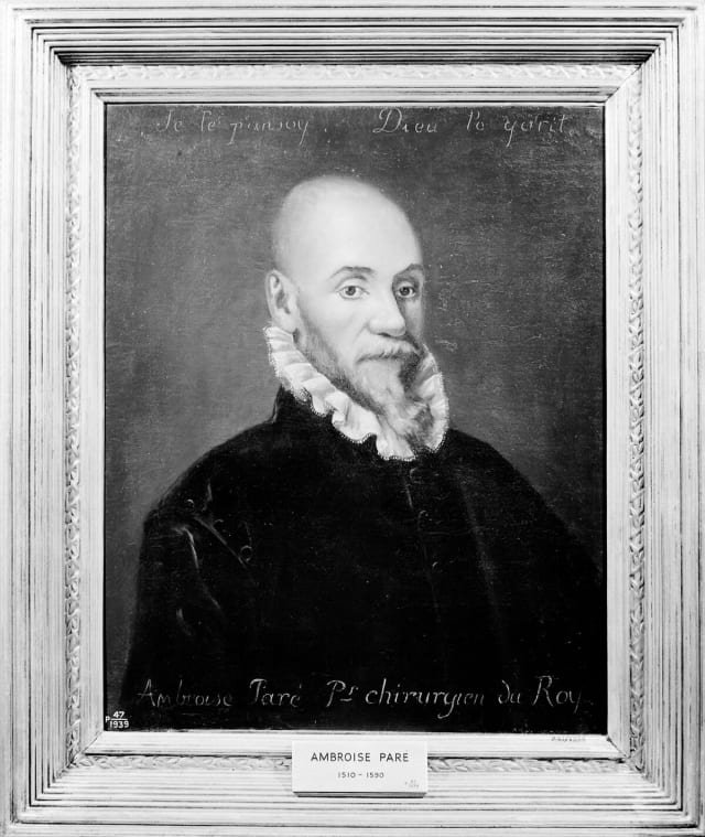 Ambroise Pare : la ligature arterielle (1552) et la naissance de la chirurgie francaise moderne