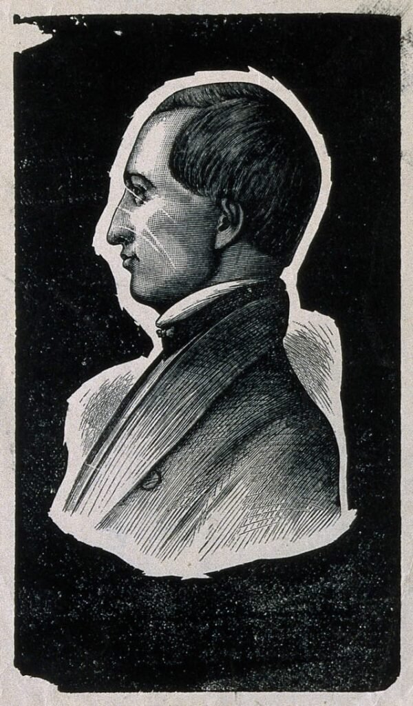 Crawford W. Long (1815-1878) : premiere anesthesie a l&rsquo;ether en 1842
