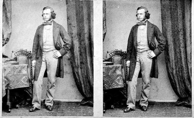Joseph Lister : l&rsquo;inventeur de l&rsquo;antisepsie chirurgicale moderne (1867)